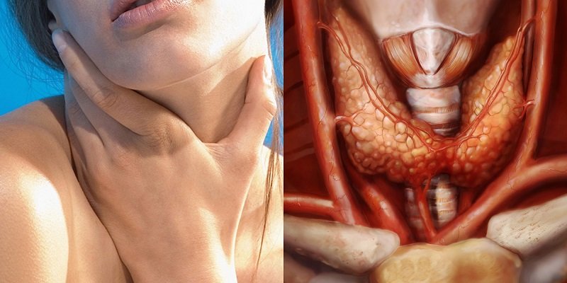 Как лечить щитовидку