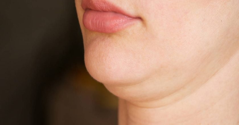 как подтянуть овал лица в домашних условиях