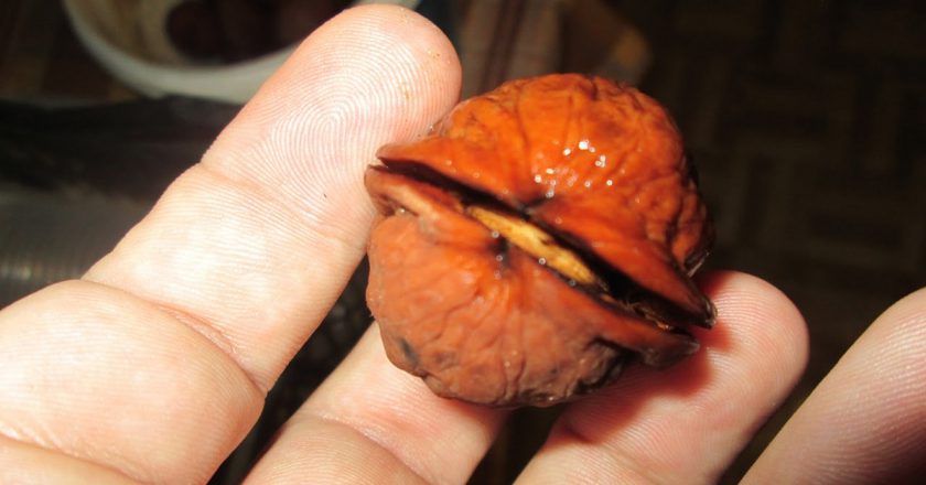 удаление волос