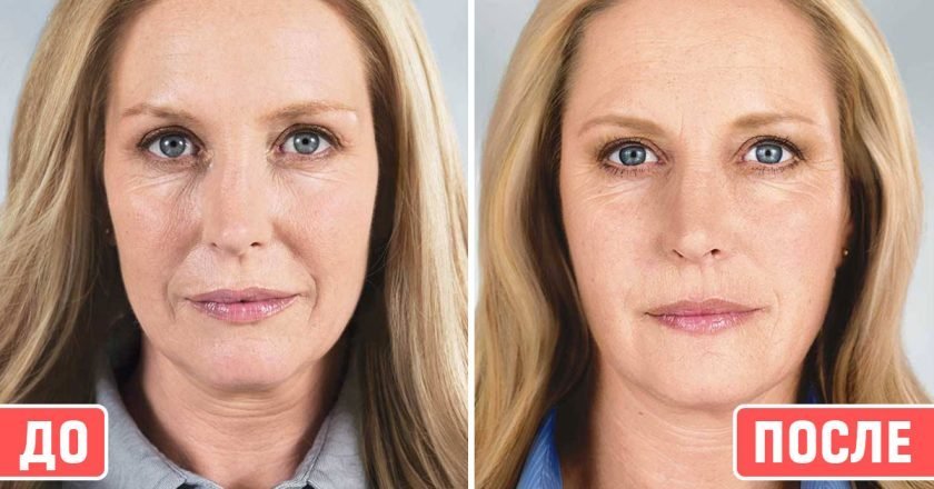 как замаскировать носогубные складки