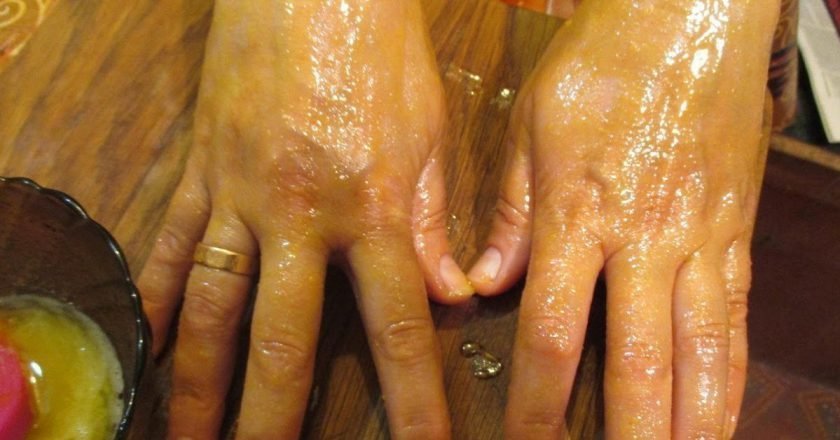 крем от трещин на руках