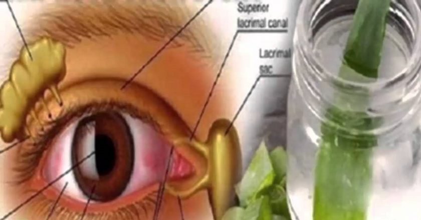 алоэ вера для глаз