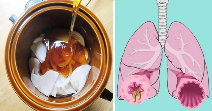 луковый мёд