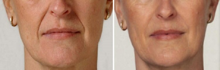 маска из кофе для лица