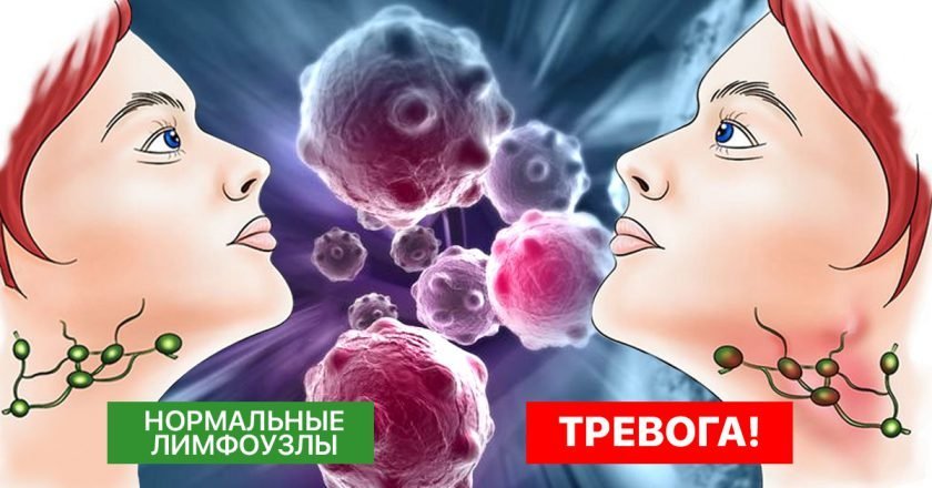 Очистка лимфы солодкой и энтеросгелем схема