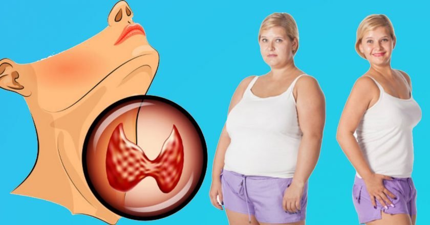 Питание при гипотиреозе