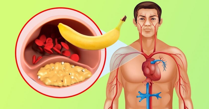 польза бананов для сосудов