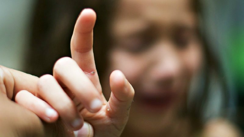 заноза в пальце