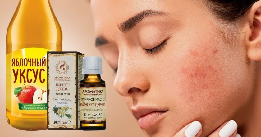 сосудистые звездочки