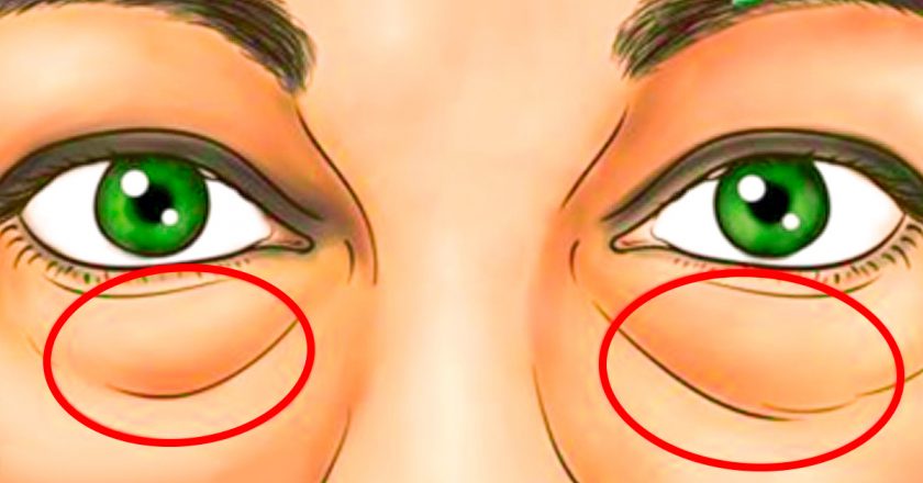 убрать круги под глазами