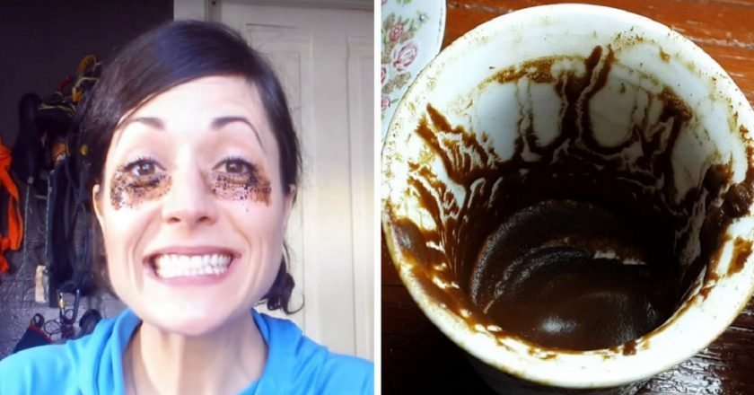 Средство от мешков под глазами