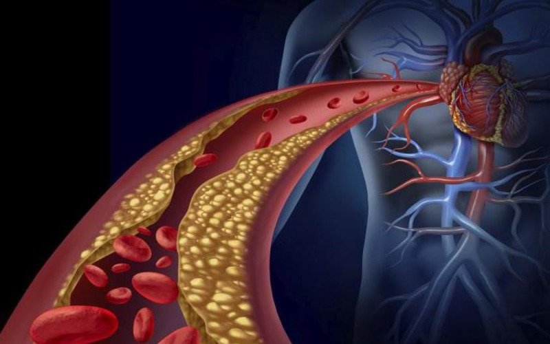 как очистить сосуды