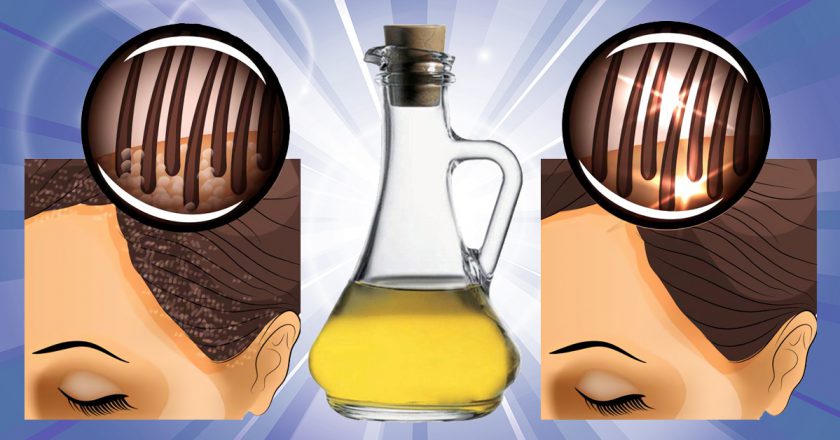 маски с уксусом от перхоти фото