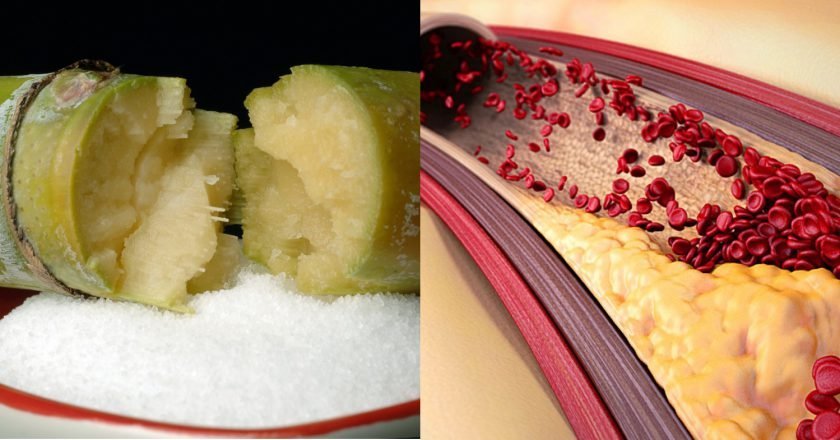 как влияет сахар на здоровье