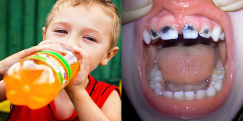 вред сладких газированных напитков